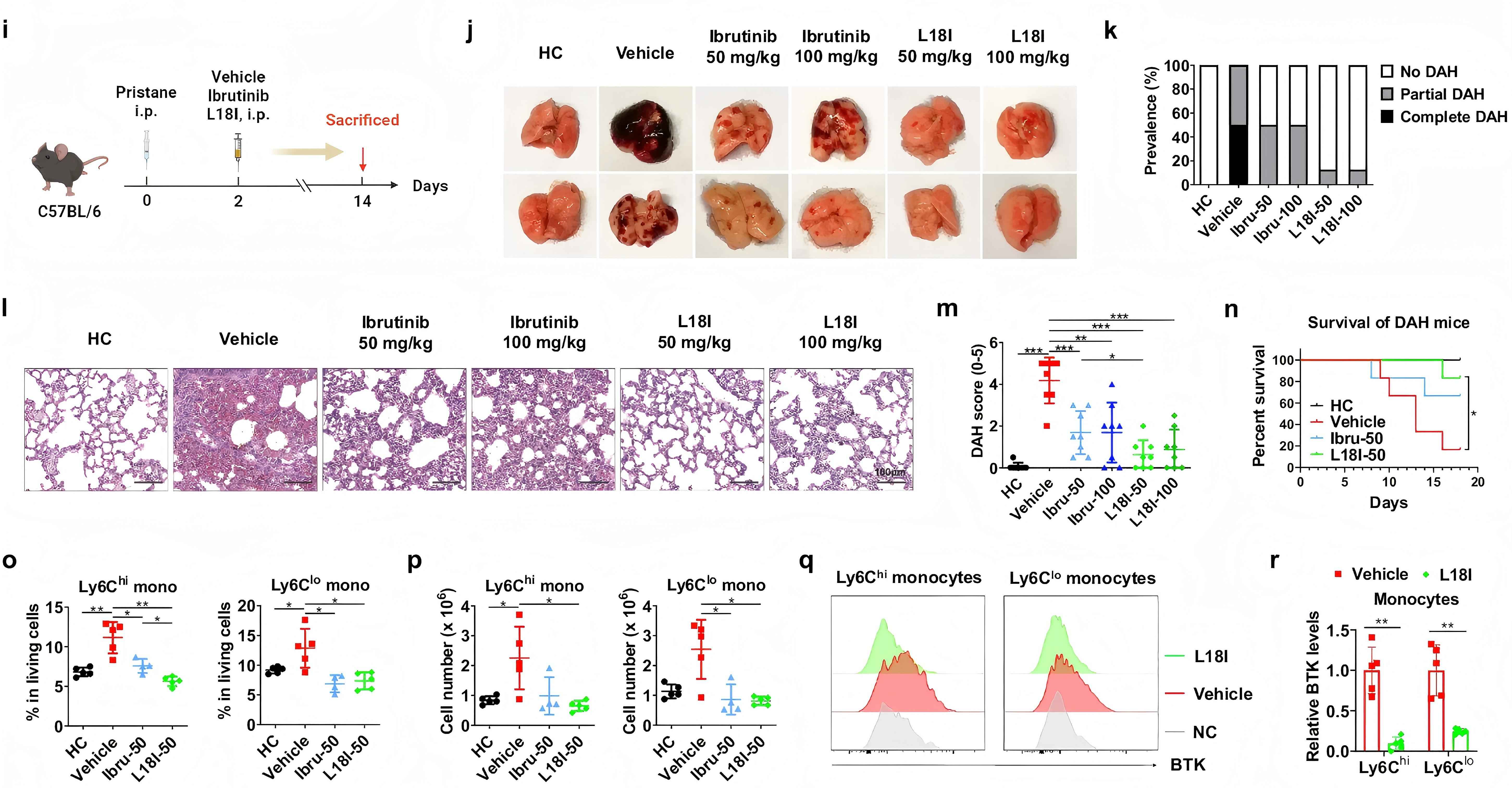 PROTAC for Bruton s tyrosine kinase degradation alleviates inflammation in autoimmune diseases